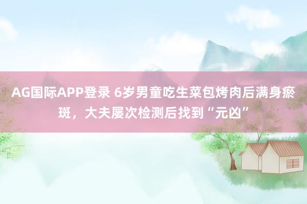AG国际APP登录 6岁男童吃生菜包烤肉后满身瘀斑,大夫屡次检测后找到“元凶”
